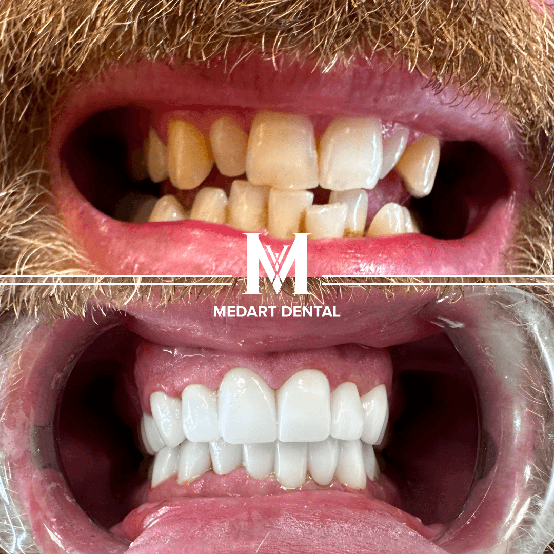 Before and after dental treatment