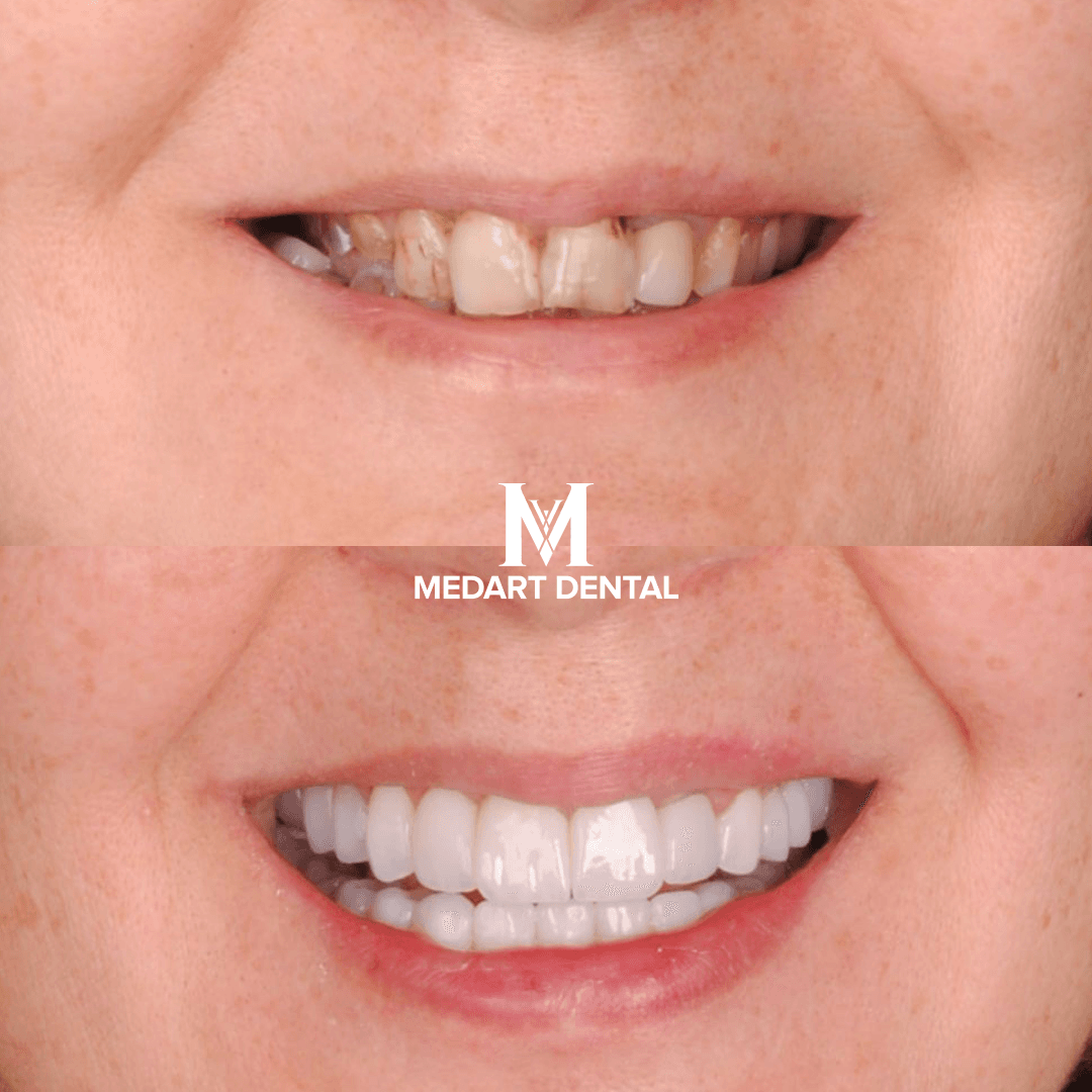 Before and after dental treatment