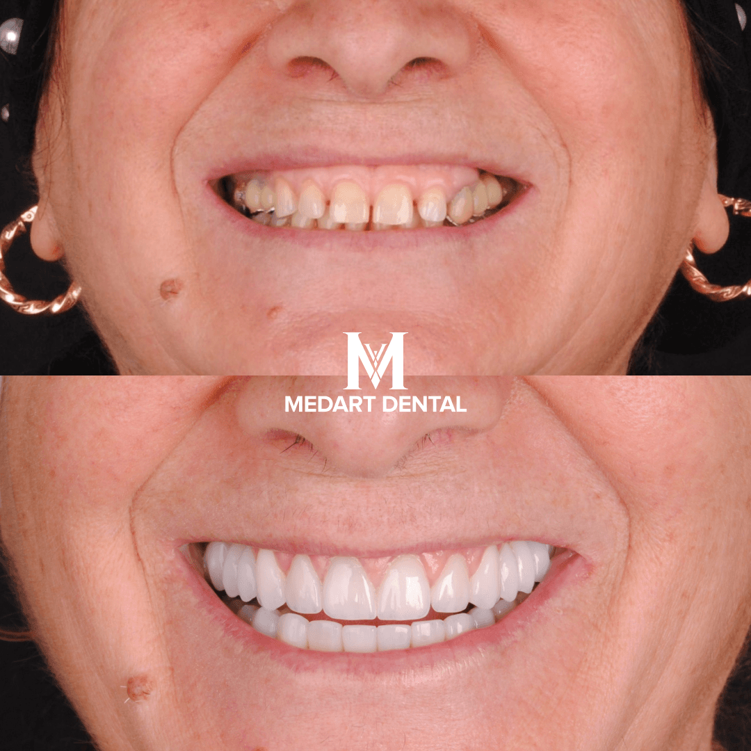 Before and after dental treatment