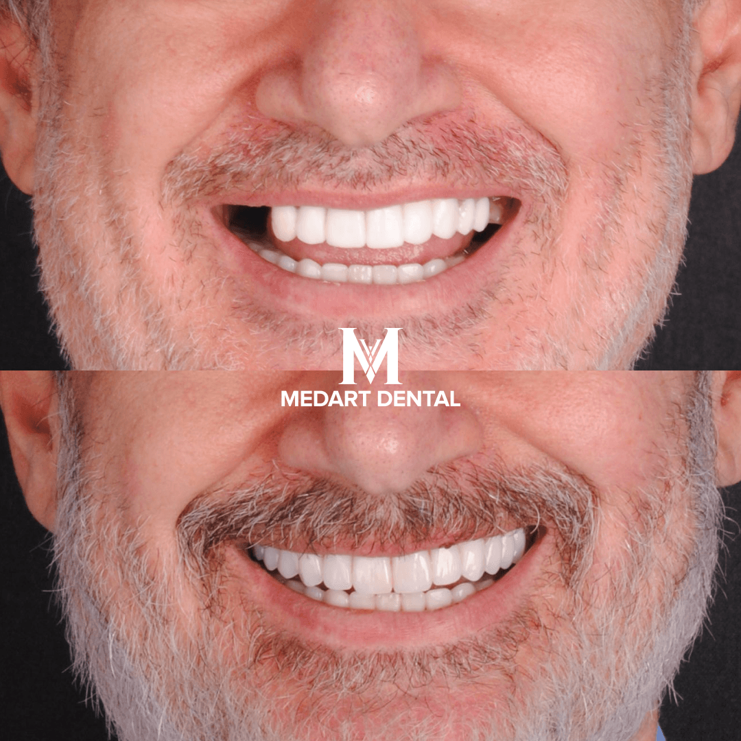 Before and after dental treatment