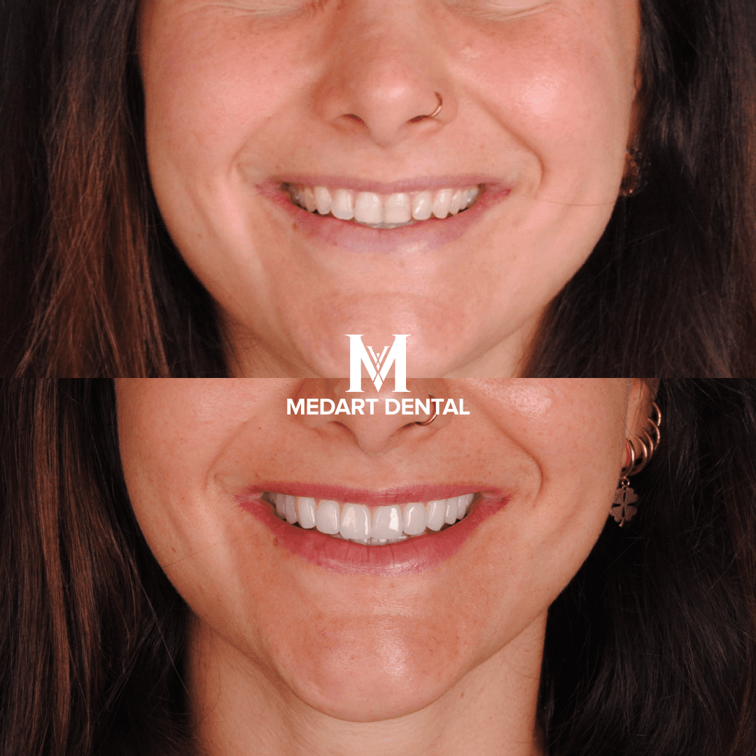 Before and after dental treatment