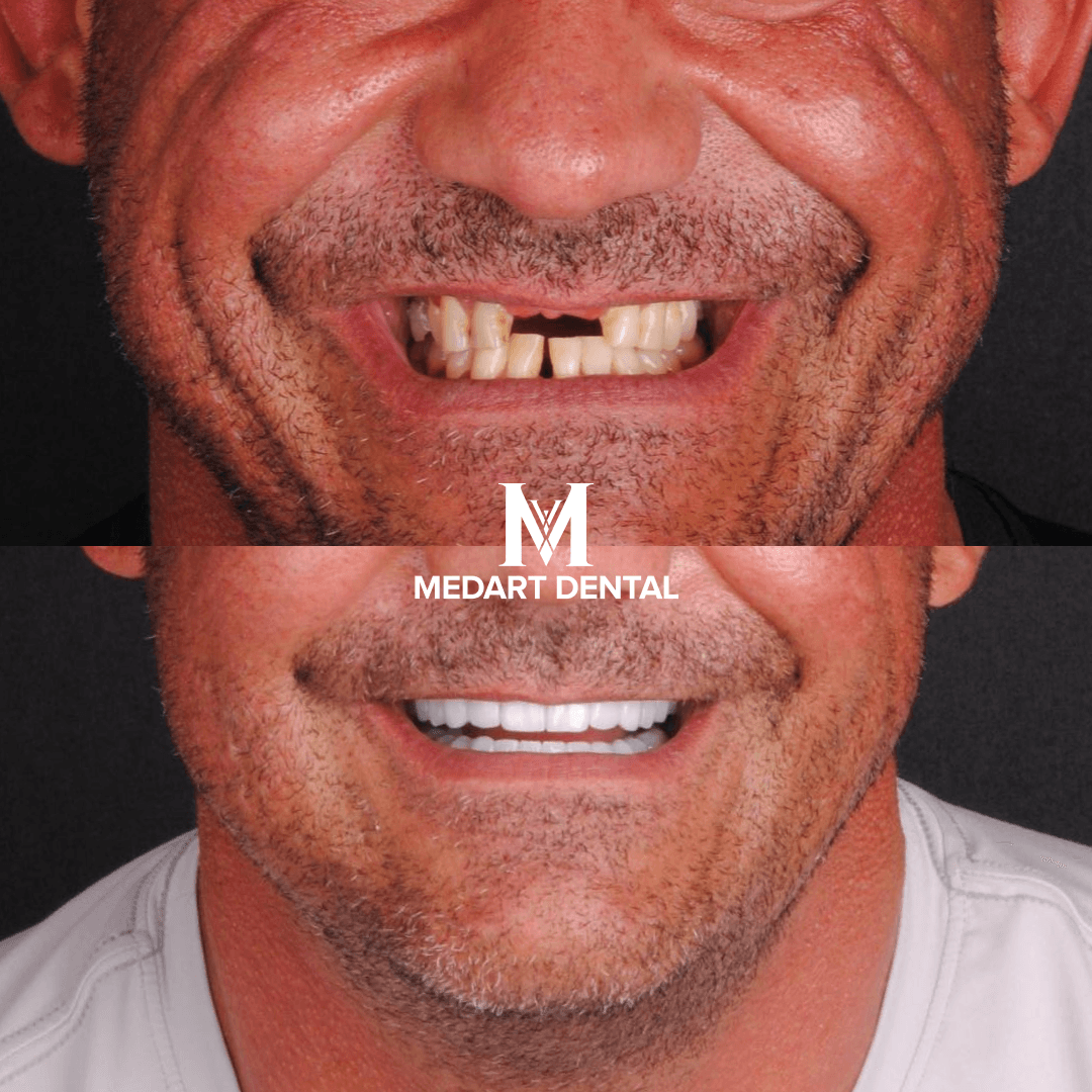 Before and after dental treatment
