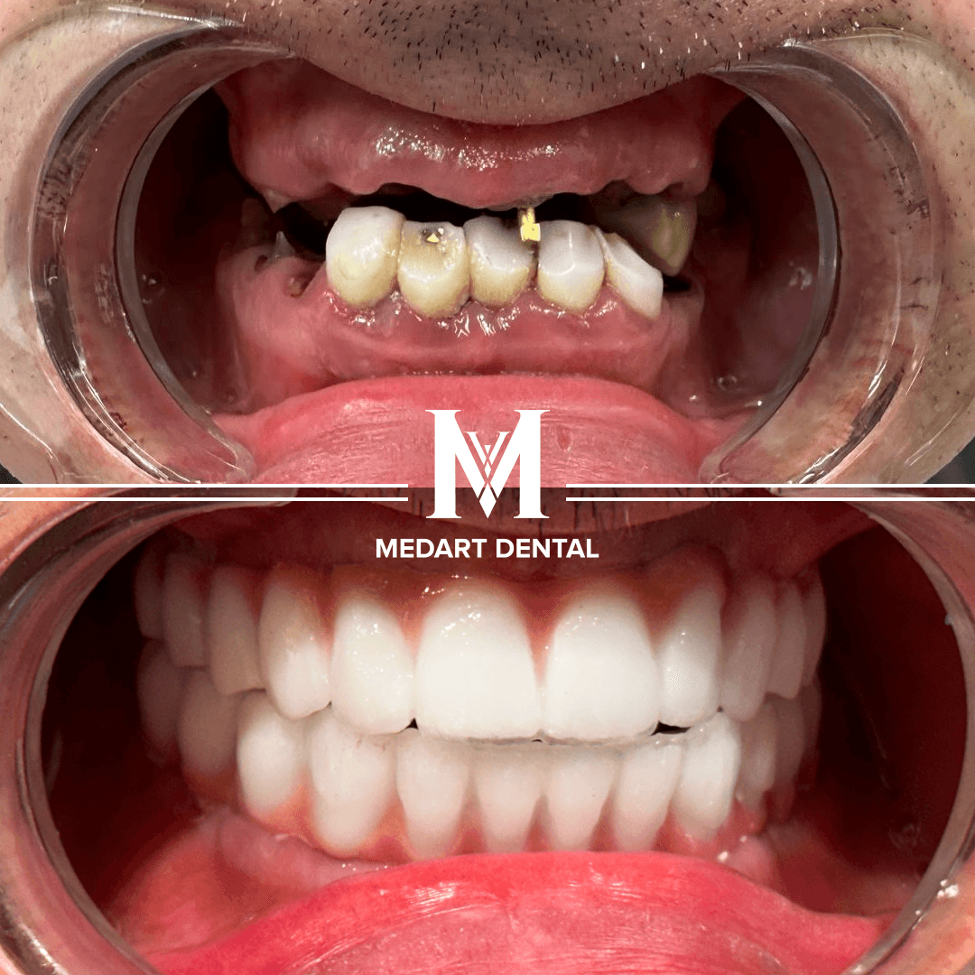 Before and after dental treatment