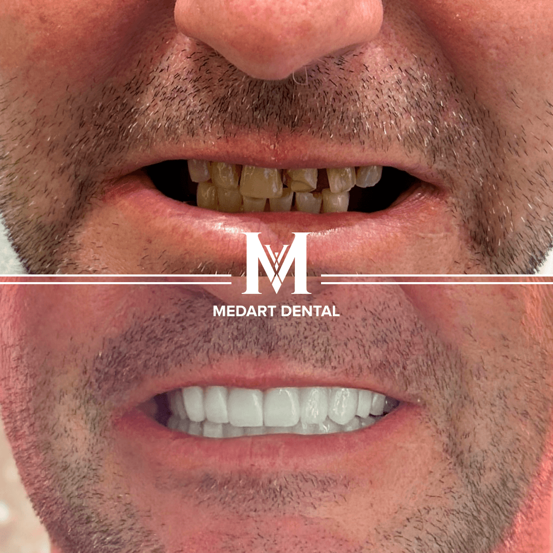 Before and after dental treatment