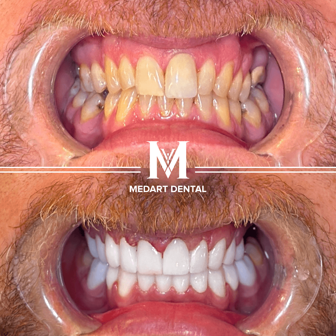 Before and after dental treatment
