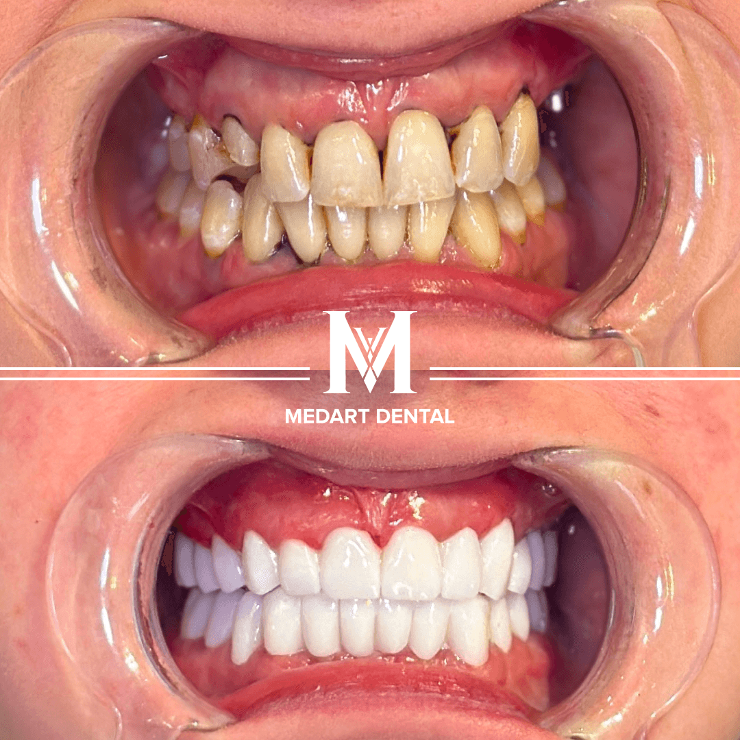 Before and after dental treatment