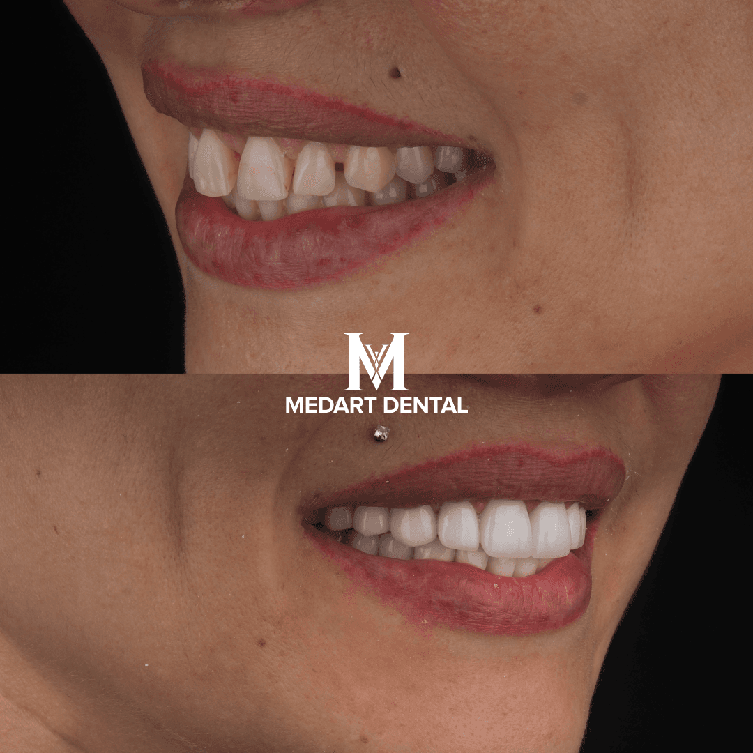 Before and after dental treatment