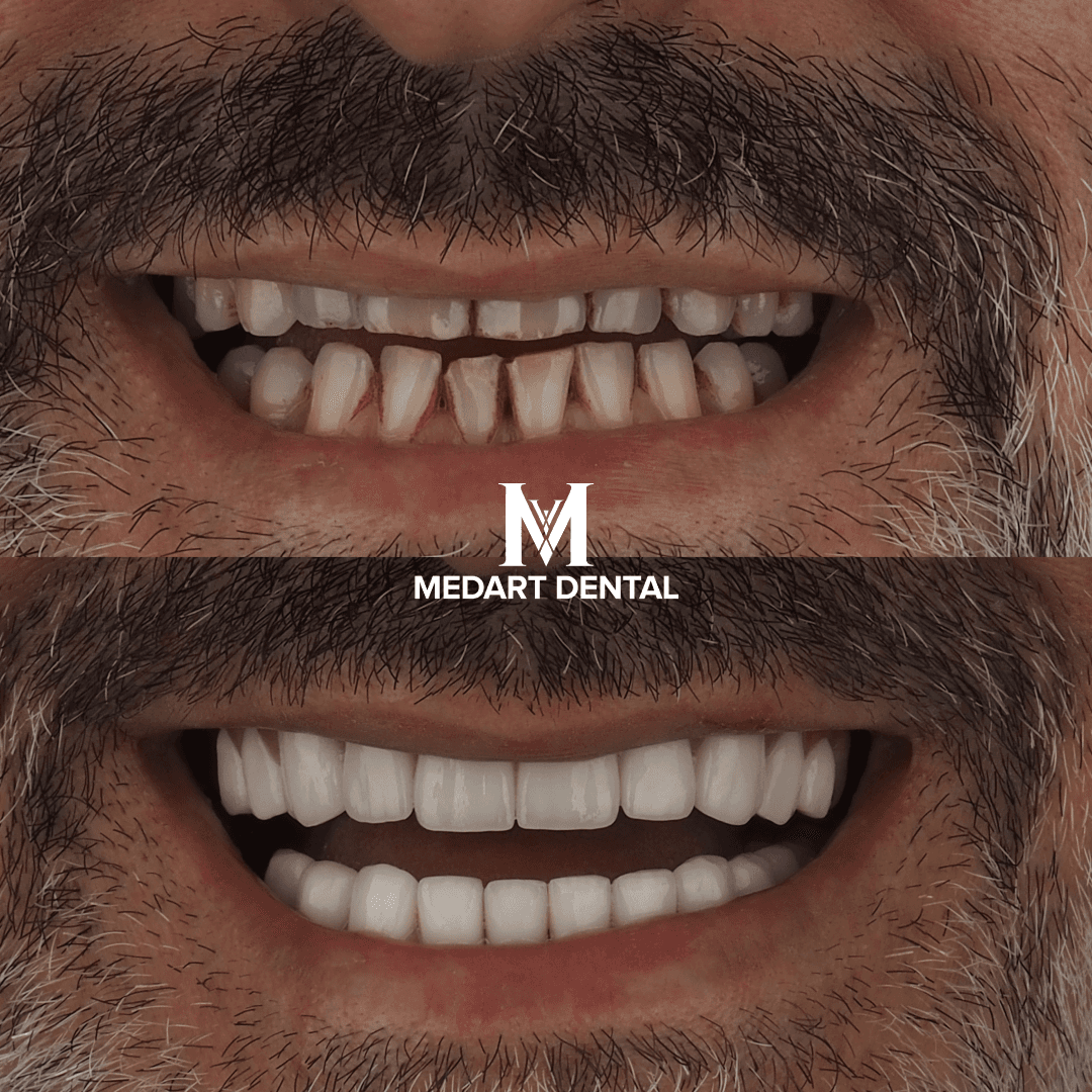 Before and after dental treatment